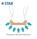 Pressure-Redistribution